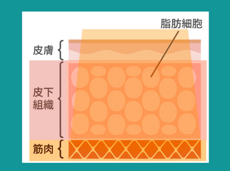 電磁パルス痩身のメカニズム